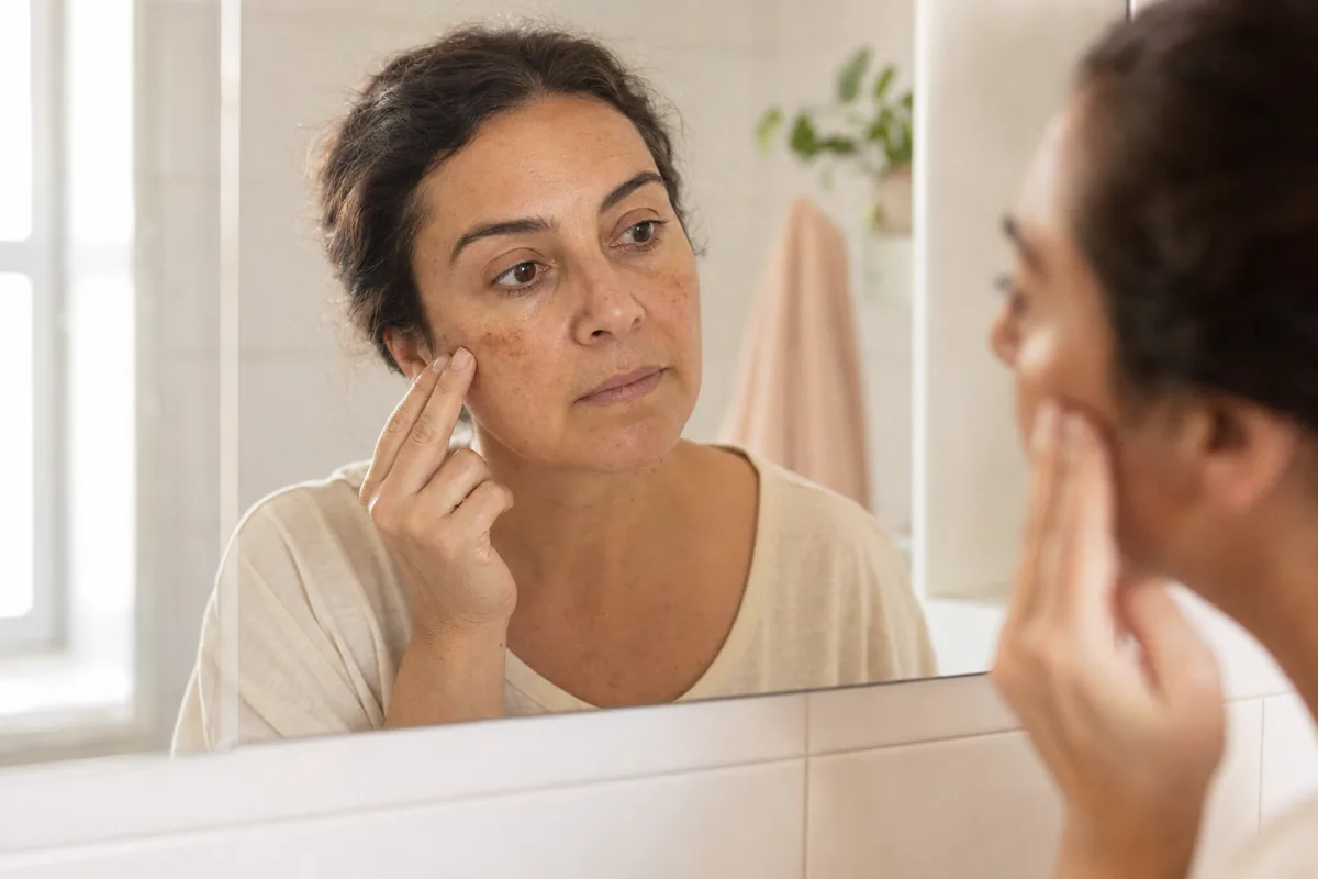 Mujer chilena observando las manchas en su pómulo frente al espejo del baño